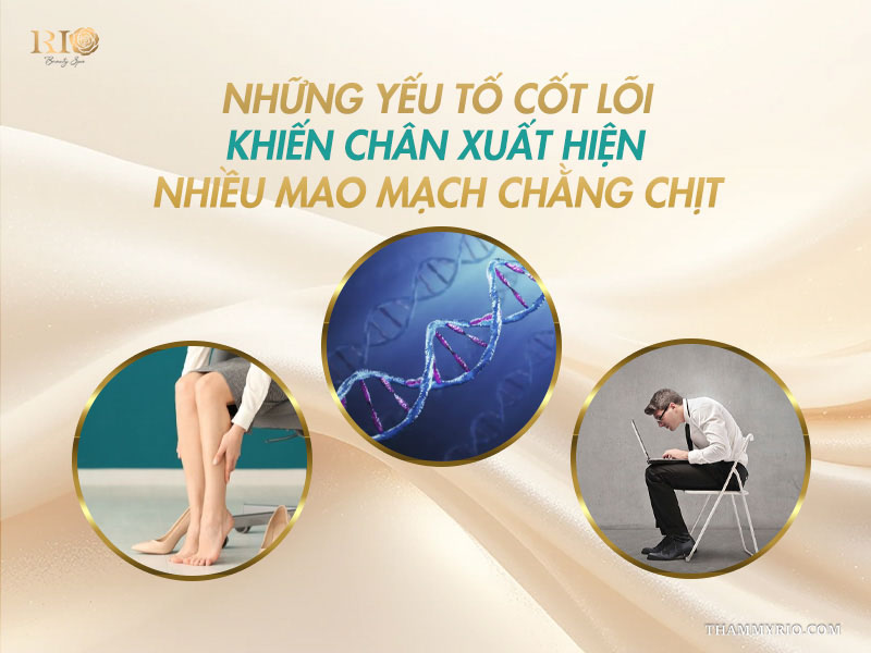 3 yếu tố cốt lõi gồm thói quen đứng ngồi lâu, di truyền ADN và ngồi sai tư thế khiến chân nổi nhiều mao mạch