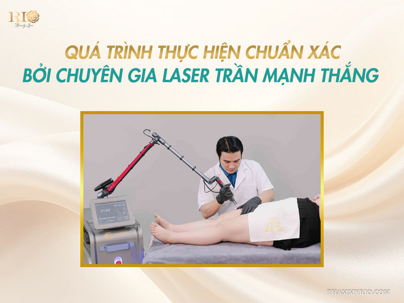 Master Trần Mạnh Thắng thao tác đầu máy laser điều trị dứt điểm tình trạng chân nổi nhiều mao mạch