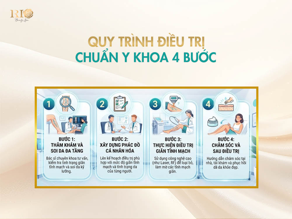 Quy trình điều trị giãn tĩnh mạch chuẩn y khoa 4 bước khép kín với công nghệ Rio Vascular Laser System