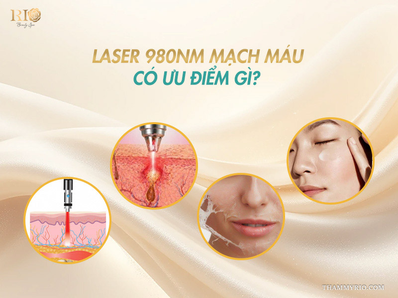 4 ưu điểm vượt trội về độ chính xác và khả năng phục hồi da của Công nghệ Bio Vein Clear Max 980 nm
