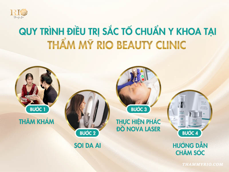 Quy trình 4 bước trị nám chuyên sâu tại Thẩm Mỹ Rio Beauty Clinic