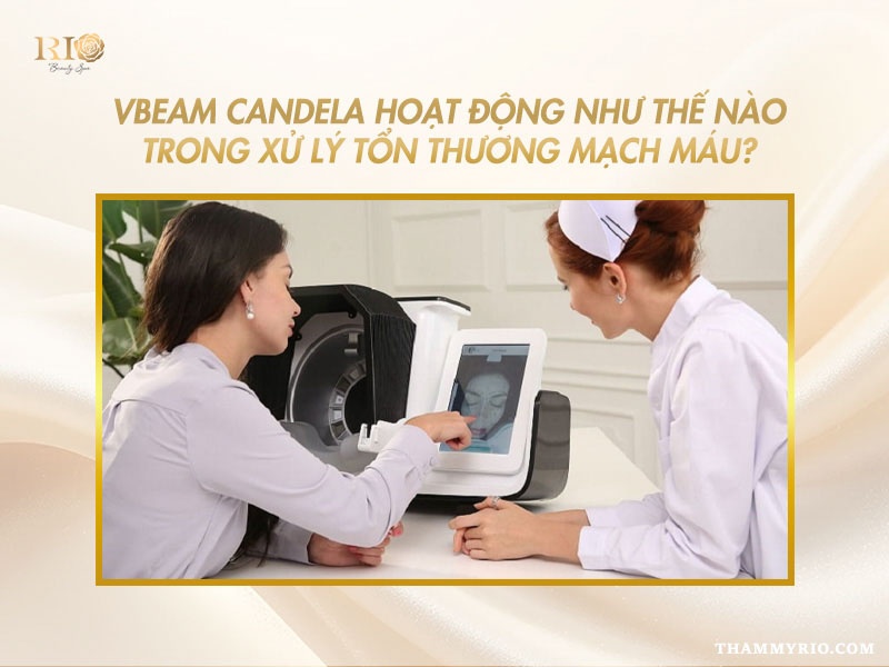 Bác sĩ và khách hàng quan sát kết quả soi da 3D phân tích cơ chế xử lý của Công nghệ Vbeam Candela 595nm