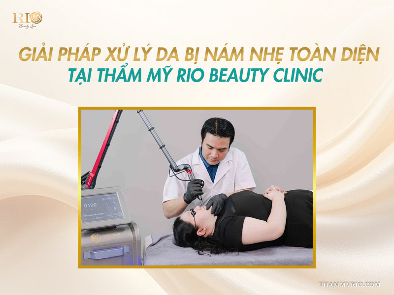 Chuyên gia Thẩm mỹ Rio thao tác máy laser chuẩn y khoa điều trị cho khách hàng da bị nám nhẹ