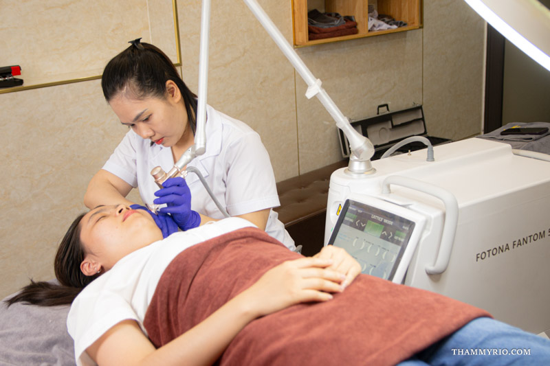Chuyên viên đeo găng tay y tế điều khiển máy laser Fotona điều trị da lộ mao mạch vùng má