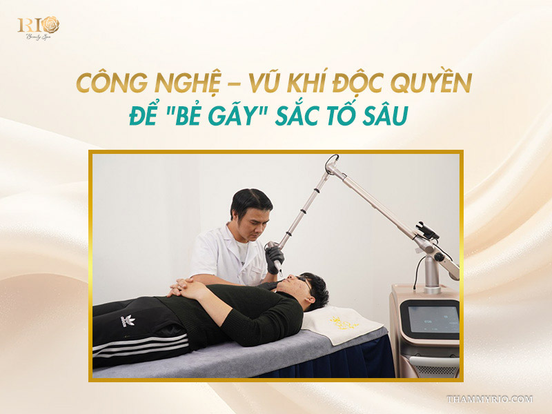 Bác sĩ Thẩm mỹ Rio sử dụng thiết bị laser trục khuỷu công nghệ cao trên banner bẻ gãy sắc tố điều trị nám chân sâu