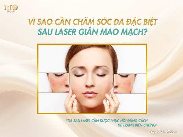 So sánh vùng má đỏ ửng giãn mao mạch trước và sau khi dùng sản phẩm Everly sau laser giãn mao mạch
