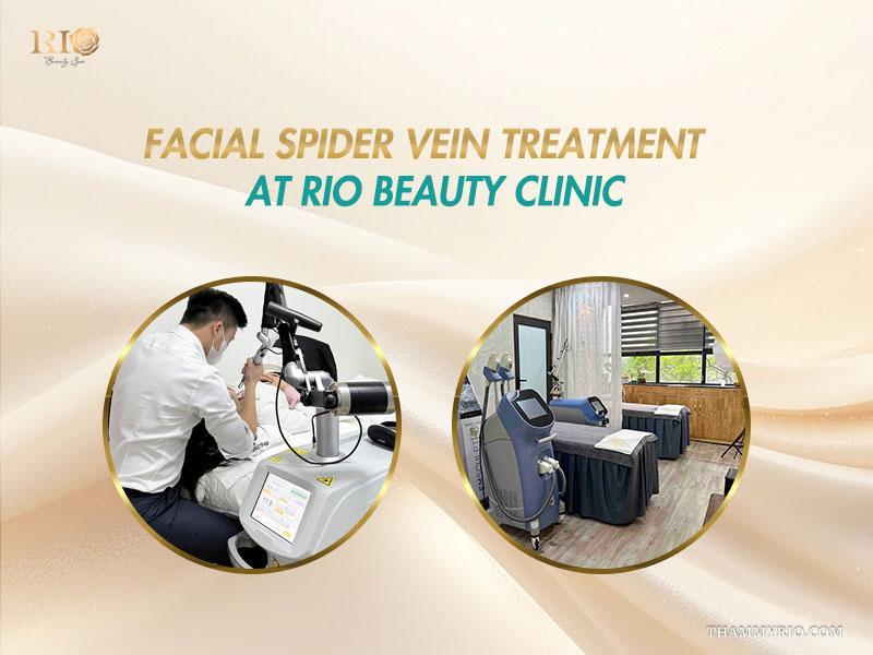 Dual circular views showing laser procedure and private clinical room for facial spider veins treatment at Rio Beauty Clinic