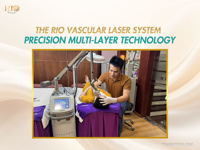 Senior specialist operating the Spectra laser system for targeted and precise facial spider veins treatment