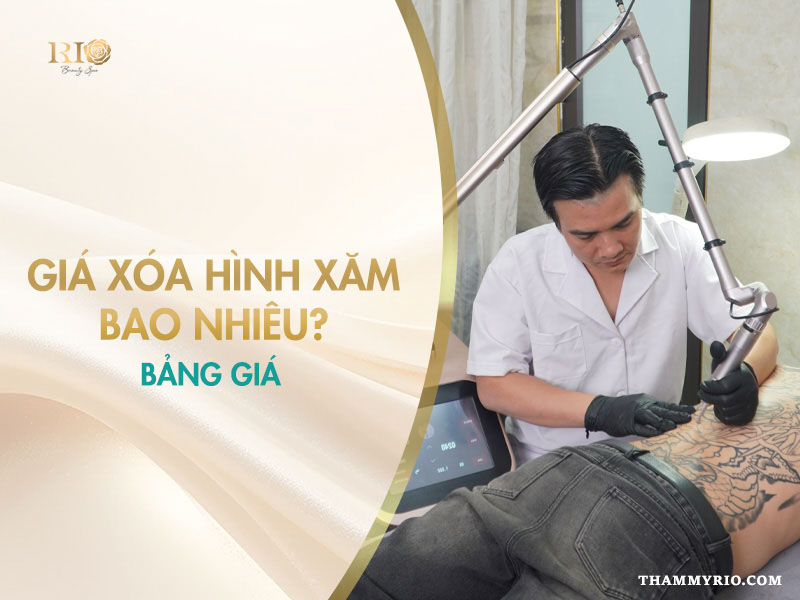giá xóa hình xăm bao nhiêu tiền tại Thẩm mỹ Rio Beauty Clinic.