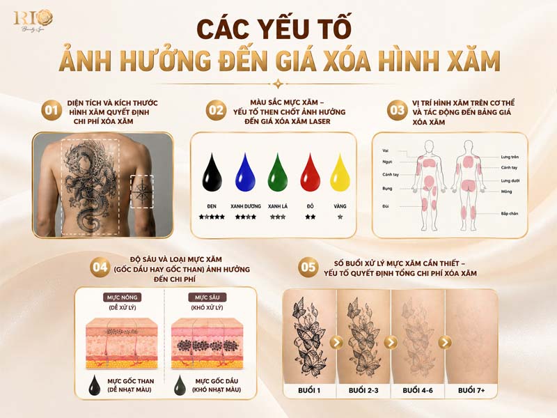 các yếu tố ảnh hưởng đến giá xóa hình xăm hiện nay.