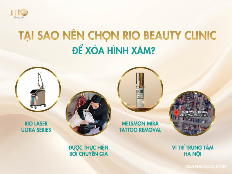 lý do chọn dịch vụ có giá xóa hình xăm tốt tại Thẩm mỹ Rio Beauty Clinic.