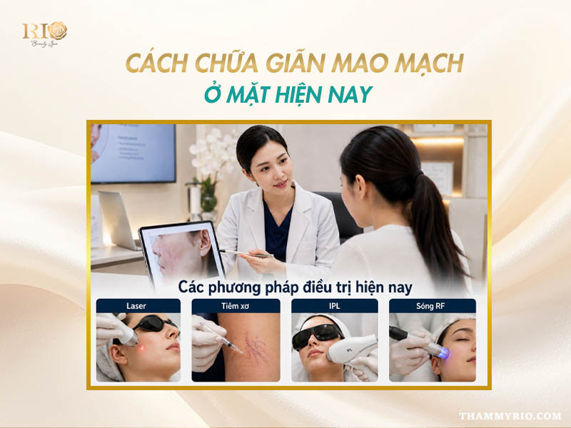 Tổng hợp các phương pháp chữa giãn mao mạch ở mặt hiện nay tại Thẩm mỹ Rio Beauty Clinic.