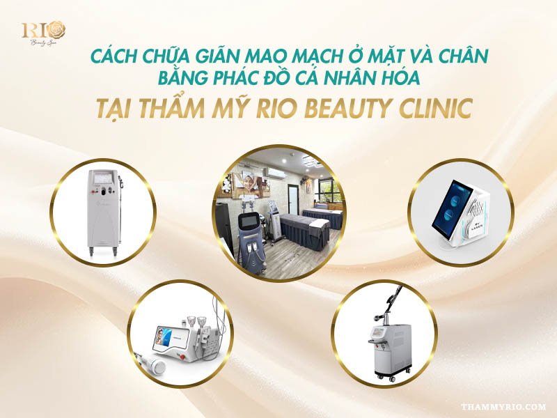 Cách chữa giãn mao mạch ở mặt và chân bằng phác đồ cá nhân hóa tại Thẩm mỹ Rio Beauty Clinic.