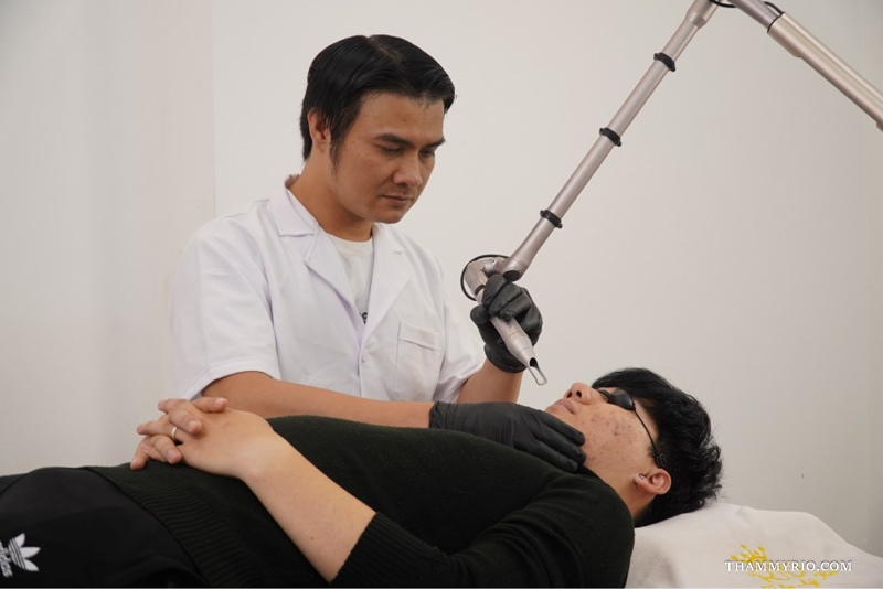 Practitioner using an articulated laser arm to treat facial pigment spots for a patient asking how can i get rid of freckles