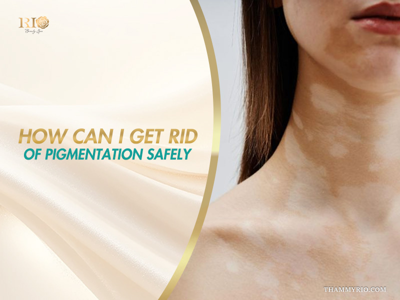 Close-up of hypopigmentation and hyperpigmentation patches along the neck and jawline on a banner addressing how can i get rid of pigmentation safely