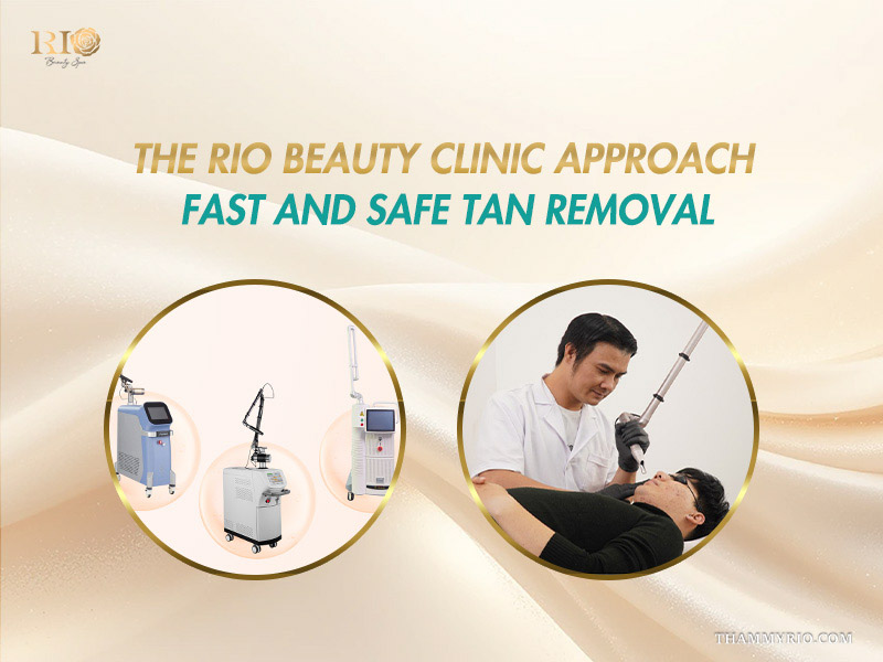 Circular graphics displaying laser machines and a specialist performing laser toning addressing how can i remove sun tan