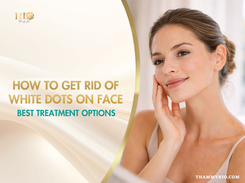 How to get rid of white dots on face with effective treatment options