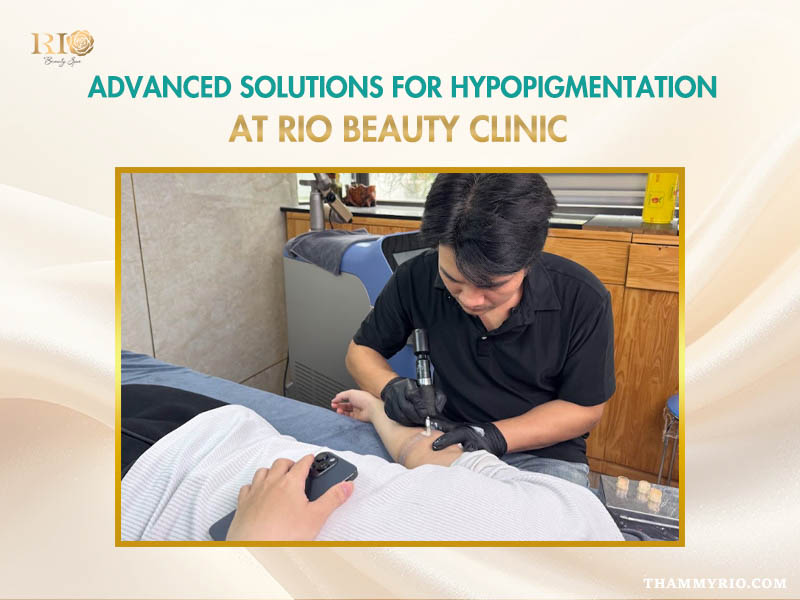 Hypopigmentation treatment before and after on arm