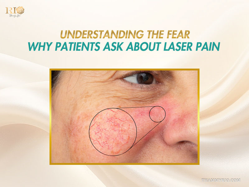 Enlarged view of facial spider veins explaining why patients worry and ask does laser vein removal hurt