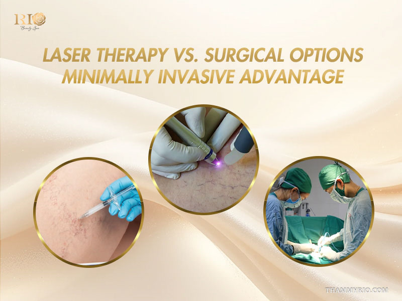Three circular frames comparing sclerotherapy injections, non-invasive laser, and vascular surgery regarding does laser vein removal hurt