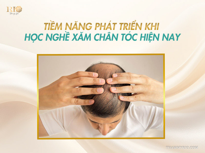 Hình ảnh da đầu hói cho thấy tiềm năng phát triển khi tham gia khóa học xăm chân tóc SMP.