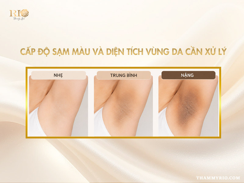 3 cấp độ sạm màu từ nhẹ đến nặng phân tích yếu tố quyết định khử thâm nách giá bao nhiêu
