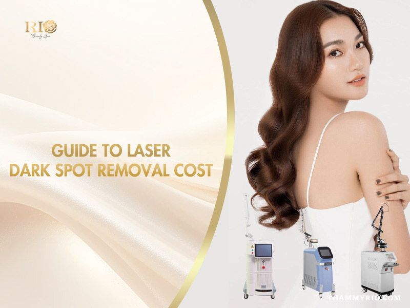 Laser dark spot removal cost guide with treatment equipment and a model showcasing clear, even-looking skin