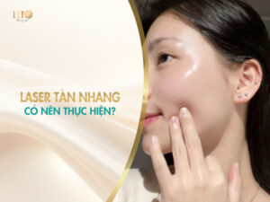 Hình ảnh cô gái có làn da sáng bóng minh họa cho câu hỏi có nên thực hiện phương pháp laser tàn nhang.