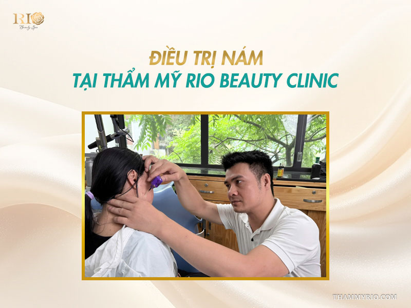 Chuyên gia Thẩm mỹ Rio trực tiếp kiểm tra và chẩn đoán cấu trúc vùng da bị nám mảng cho nữ khách hàng