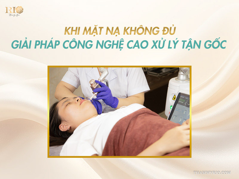 Chuyên gia thực hiện chiếu laser công nghệ cao khi đắp mặt nạ cho da bị giãn mao mạch không đủ hiệu quả tận gốc