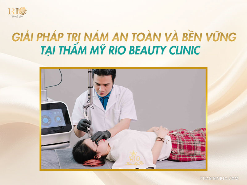 Giải pháp điều trị nám chuyên sâu an toàn tại Thẩm mỹ Rio Beauty Clinic.