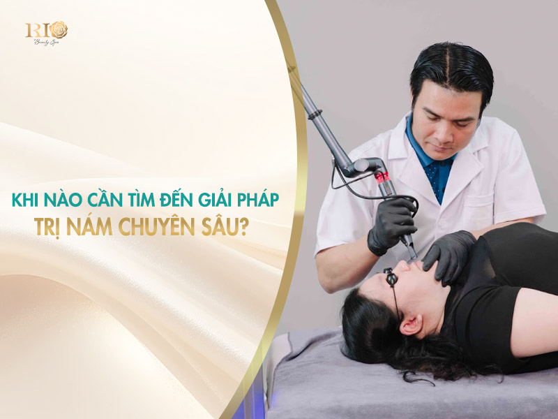 Trị nám chuyên sâu bằng laser thay thế phương pháp tự nhiên.