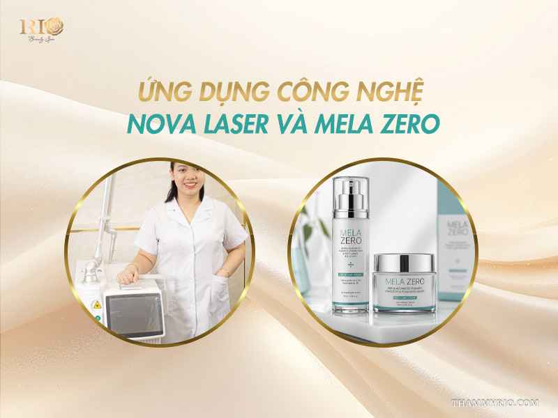 Chuyên viên Thẩm mỹ Rio bên thiết bị Nova Laser cạnh bộ dược mỹ phẩm Mela Zero trên banner ứng dụng công nghệ trị nám