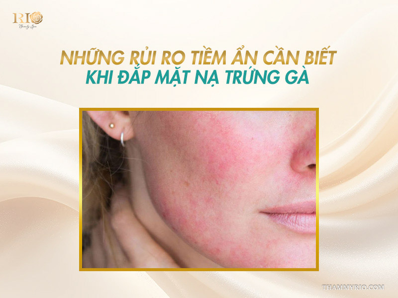 Cận cảnh làn da má bị mẩn đỏ, nốt dị ứng do kích ứng với thành phần mặt nạ trứng gà tự làm