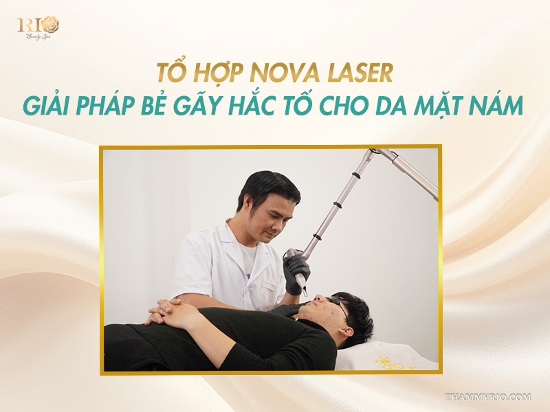 Bác sĩ Thẩm mỹ Rio thao tác máy Nova Laser chuẩn y khoa điều trị hắc tố cho khách hàng bị mặt nám