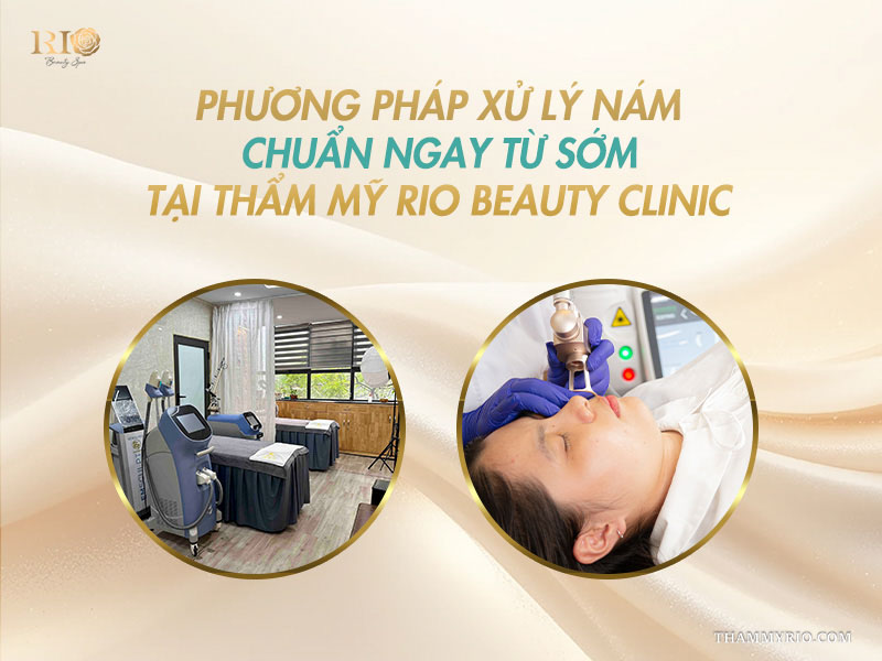 Không gian phòng trị liệu hiện đại cùng hình ảnh kỹ thuật viên thao tác máy laser điều trị nám tại Thẩm mỹ Rio