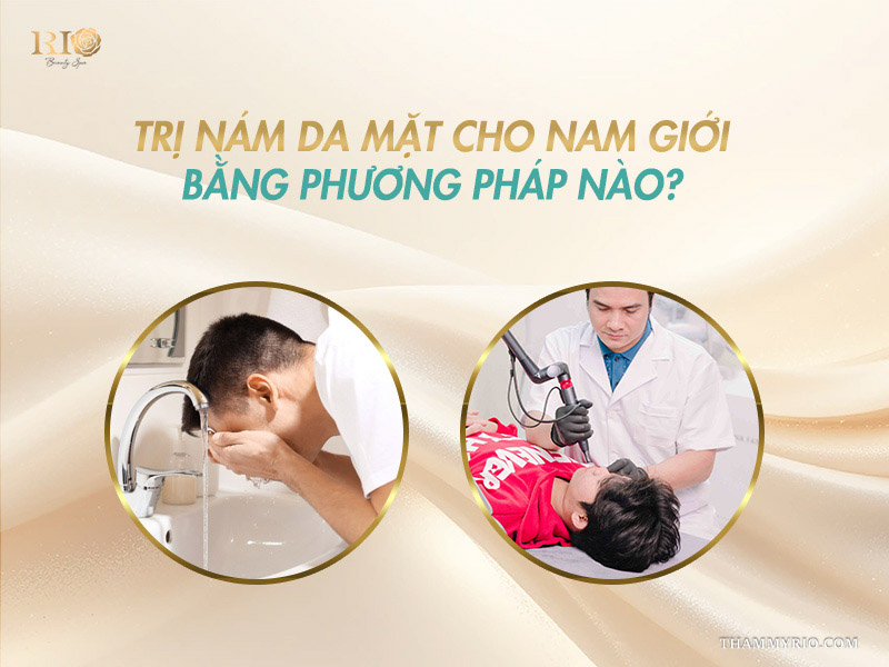 Trị nám da mặt ở nam giới bằng phương pháp nào chuẩn y khoa.