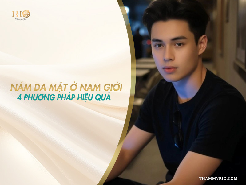 Trị nám da mặt ở nam giới bằng phương pháp nào chuẩn y khoa.