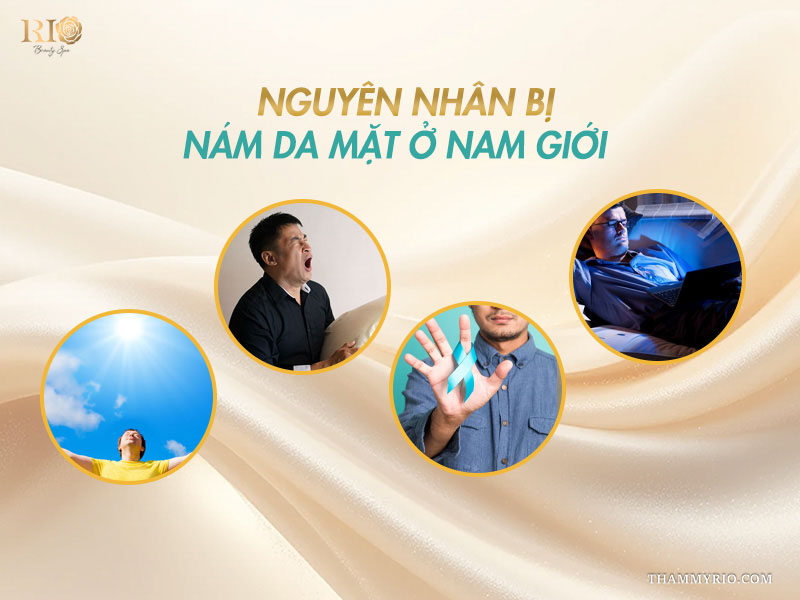 Những nguyên nhân bị nám da mặt ở nam giới thường gặp.