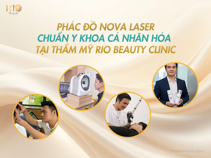 Phác đồ điều trị nám da mặt ở nam giới bằng công nghệ Nova Laser.