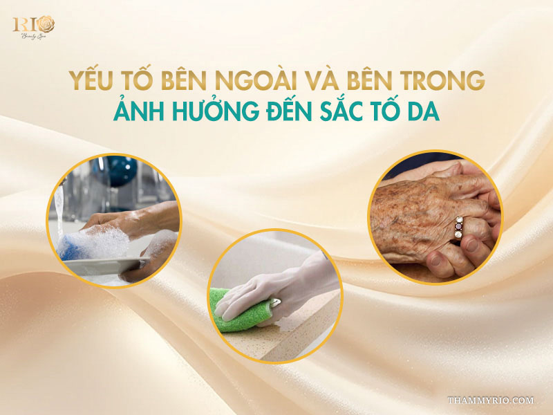 3 hình ảnh tròn minh họa các yếu tố gây nám da tay như tiếp xúc hóa chất rửa chén, chất tẩy rửa và lão hóa tự nhiên
