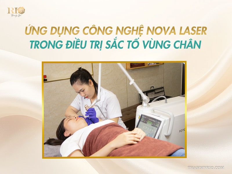 Chuyên viên Thẩm mỹ Rio thao tác thiết bị Nova Laser chuẩn y khoa trên banner ứng dụng công nghệ điều trị nám ở chân