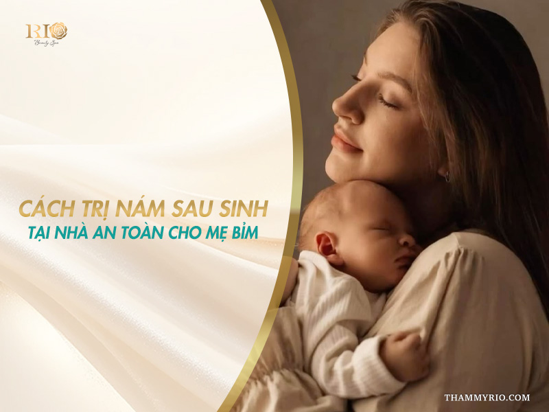 nám sau sinh có tự hết không