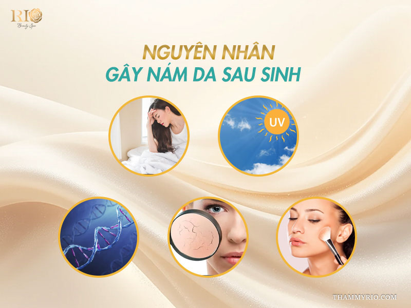 nguyên nhân gây nám da sau sinh
