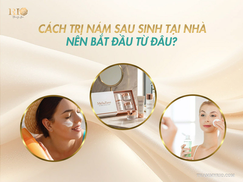 cách trị nám sau sinh tại nhà nên bắt đầu từ đâu
