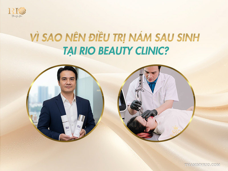vì sao nên điều trị nám sau sinh tại Rio Beauty Clinic