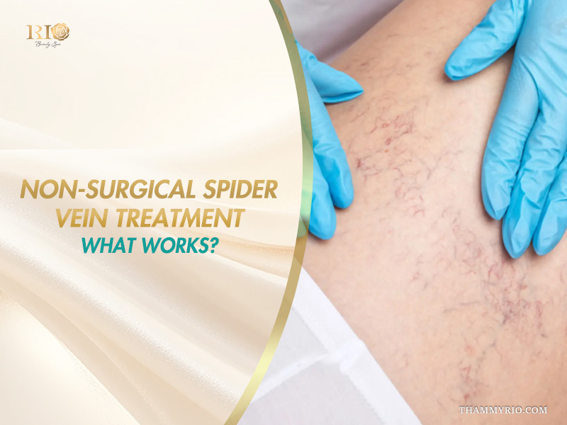 Medical practitioner examining dilated leg veins on a banner explaining non surgical spider vein treatment options