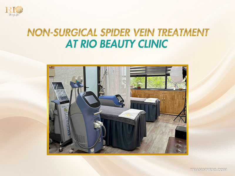 Modern treatment room equipped with advanced laser systems for non surgical spider vein treatment at Rio Beauty Clinic