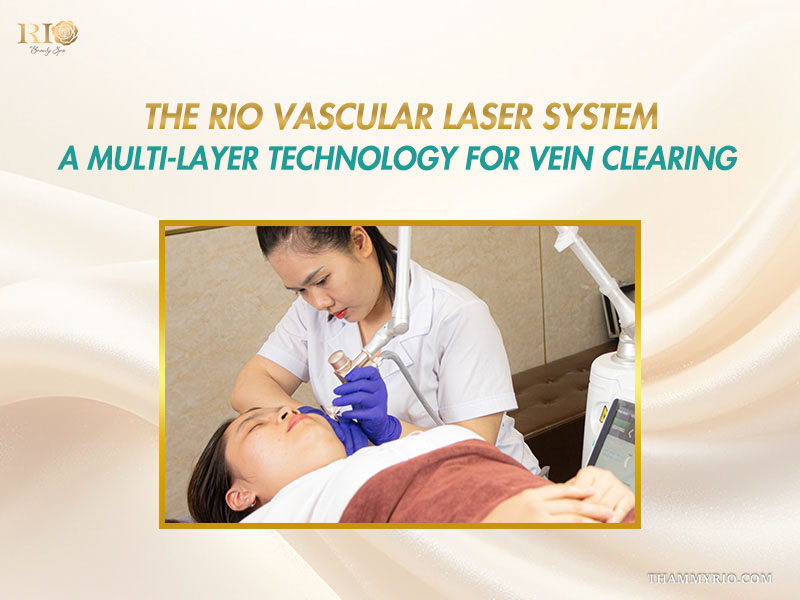 Aesthetic practitioner performing multi-layer laser therapy as part of non surgical spider vein treatment