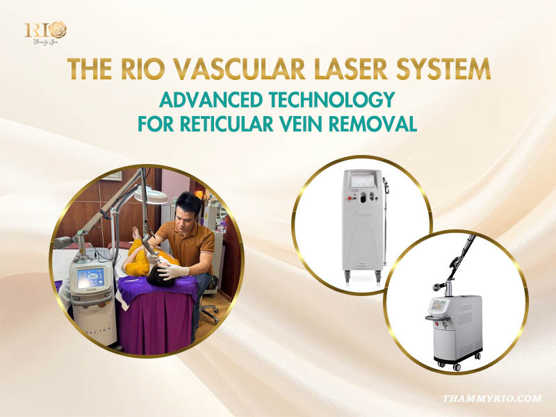 Modern vascular laser system utilized for safe and effective reticular vein treatment.
